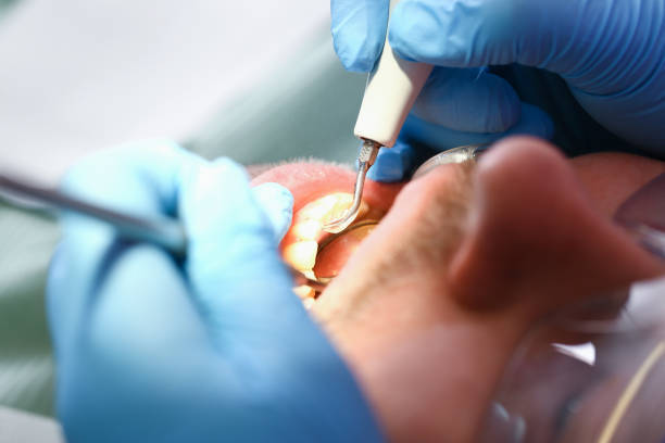Best Emergency Dental Care for Trauma or Injury in Aspermont, TX