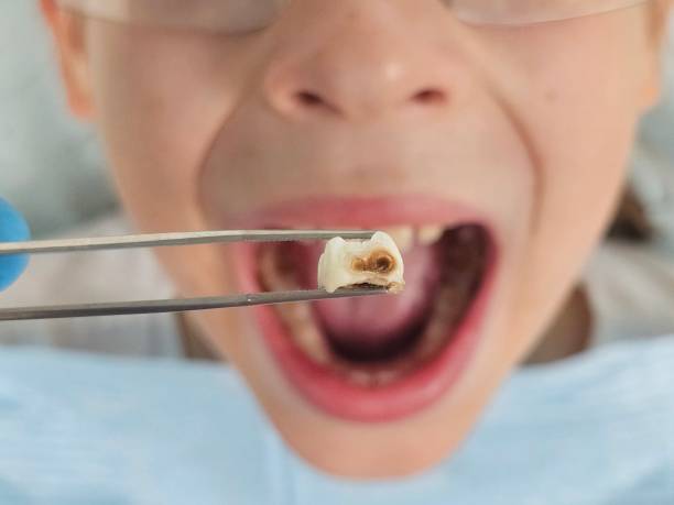 Best Emergency Orthodontic Repairs in Aspermont, TX