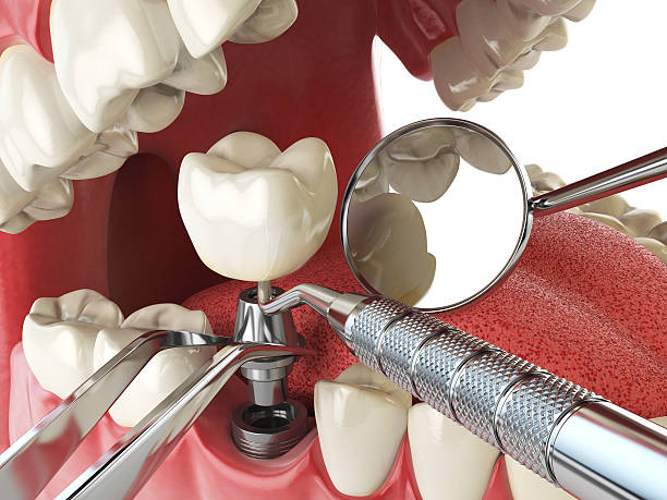 Best Emergency Orthodontic Repairs in Aspermont, TX